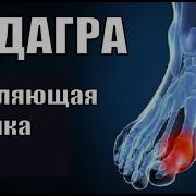 Музыка Для Лечения Подагры