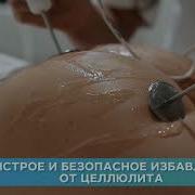 Кирасиви И Бели Сиска