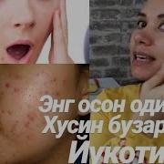 Хусинбузар Угри Йукотиш Энг Осон Супер Никоб Юзни Окартиришни Табиий