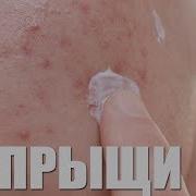 Тоза Угри