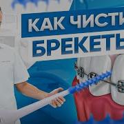 Как Чистить Брекеты