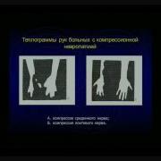 Лекции По Неврологии Для Врачей
