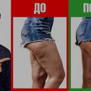 Убираем Целлюлит