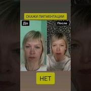 Нет Нет Нет Нет Стеллар
