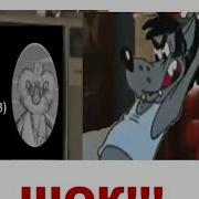 Айбольно В Ноге На Жопе Rytp 2