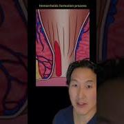 Anal In My Mind