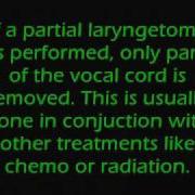 Laryngectomy By Carollovesdj