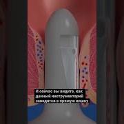 Пизда Парня Ебут В Попу