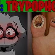 Talking Bella Trypophobia