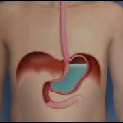 Acid Flux