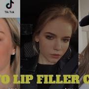 Hey Yo Lip Filler Check Tik Tok Compilation