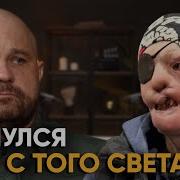 Моя Семья Убрала Все Фото Со Мной 30 Дней Комы 15 Операций Побег В Детдом И Тюрьма