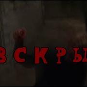 Я Кажется Руку Поцарапал