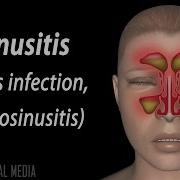 Sinus