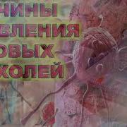 Бемории Рак Чихел Пайдо Мешавад