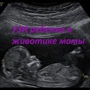 Узи Ребенка В Животике Мамы