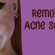 Remove Acne Scars Subliminal Mmm Formula Psyche