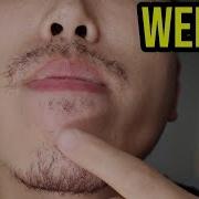 Asian Beard Growth Using Minoxidil Week 2 Results